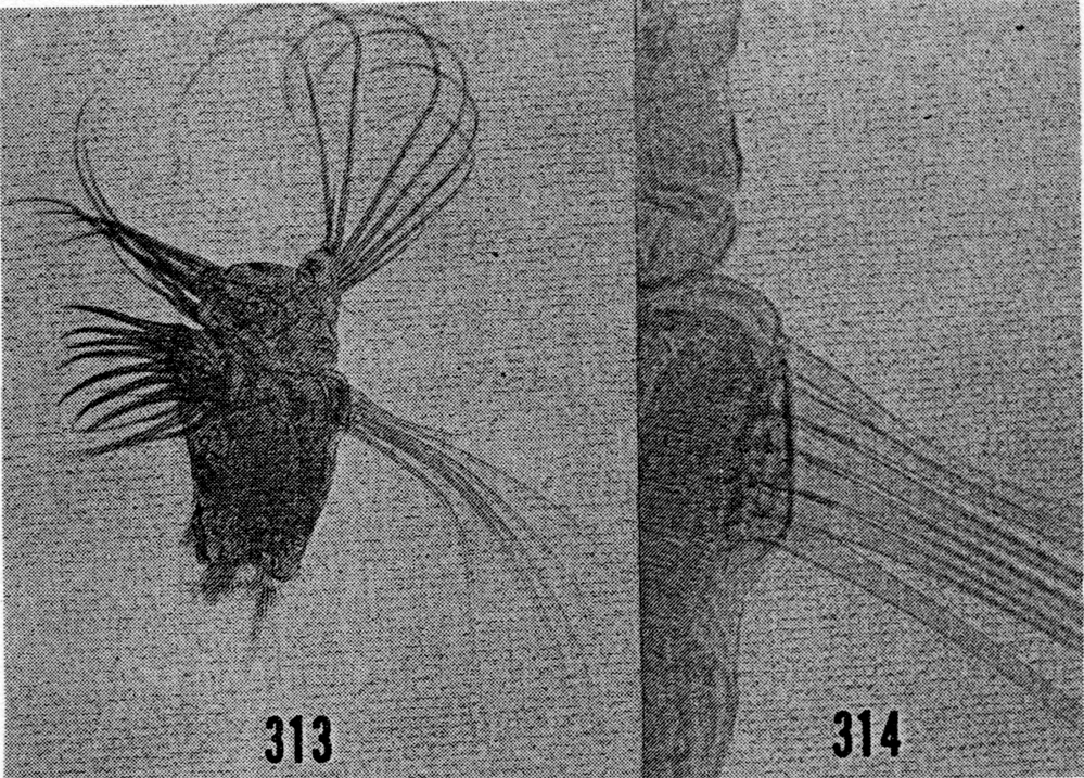 Espèce Paraeuchaeta bisinuata - Planche 18 de figures morphologiques