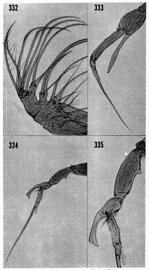 Espèce Euchaeta marina - Planche 13 de figures morphologiques