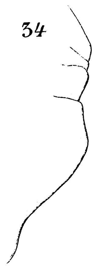 Espce Euchaeta spinosa - Planche 18 de figures morphologiques