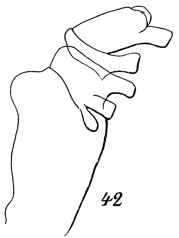 Espce Paraeuchaeta grandiremis - Planche 4 de figures morphologiques