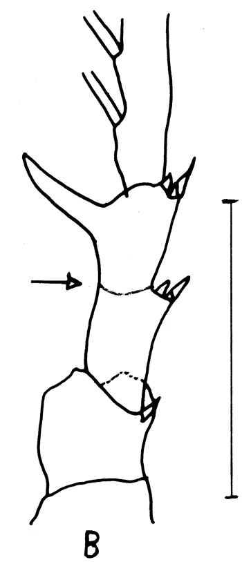Espèce Centropages ponticus - Planche 21 de figures morphologiques
