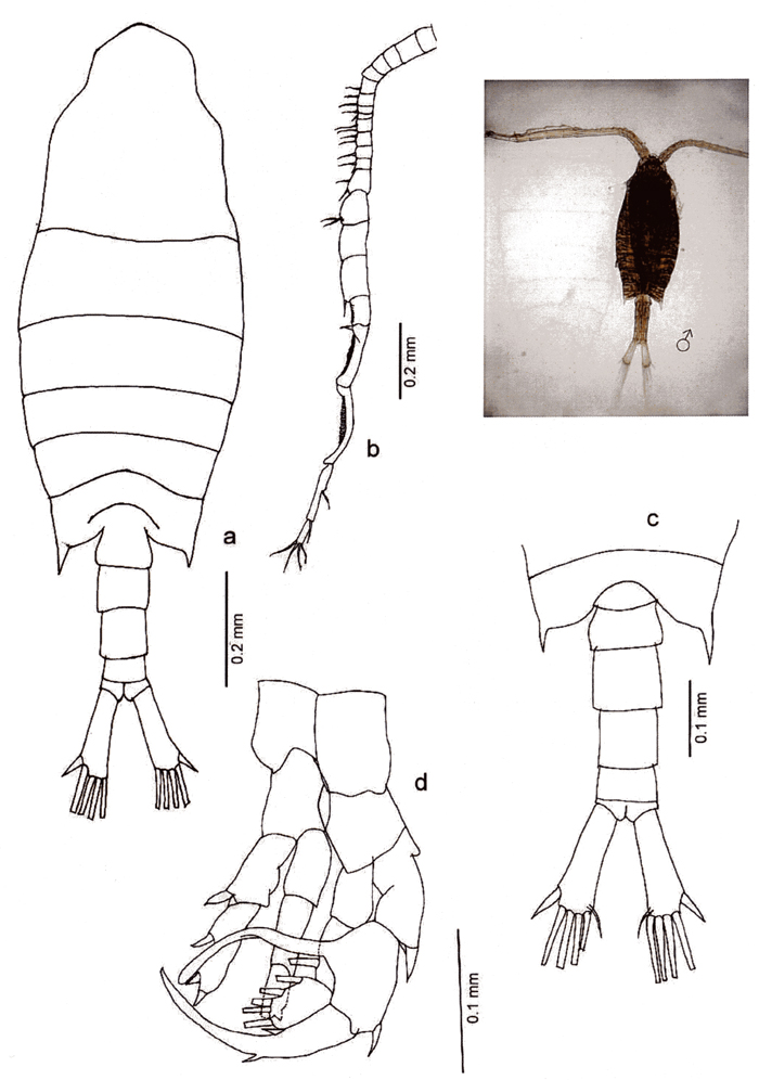 Espèce Centropages tenuiremis - Planche 10 de figures morphologiques