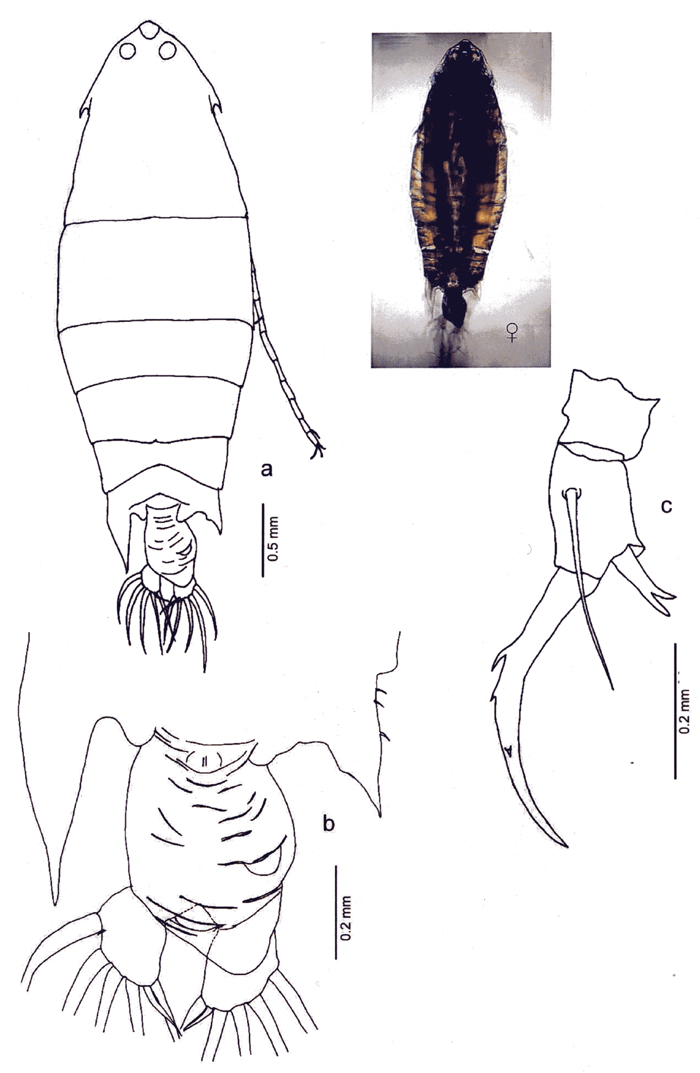 Espèce Pontella spinipes - Planche 9 de figures morphologiques
