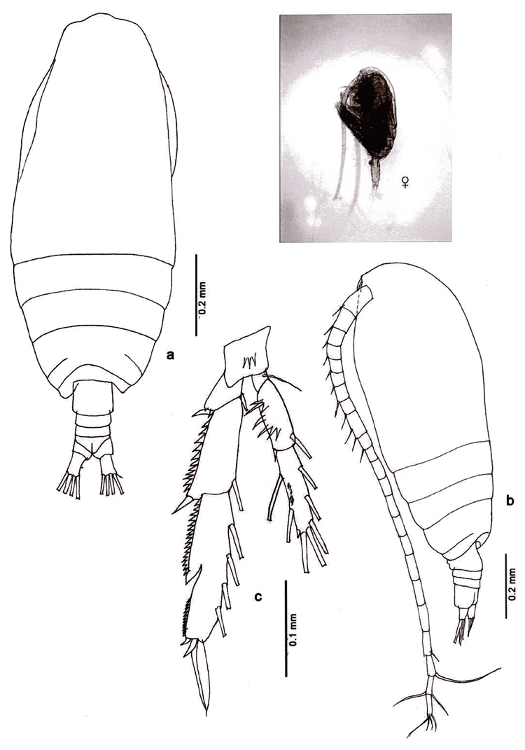 Espce Acrocalanus gracilis - Planche 10 de figures morphologiques