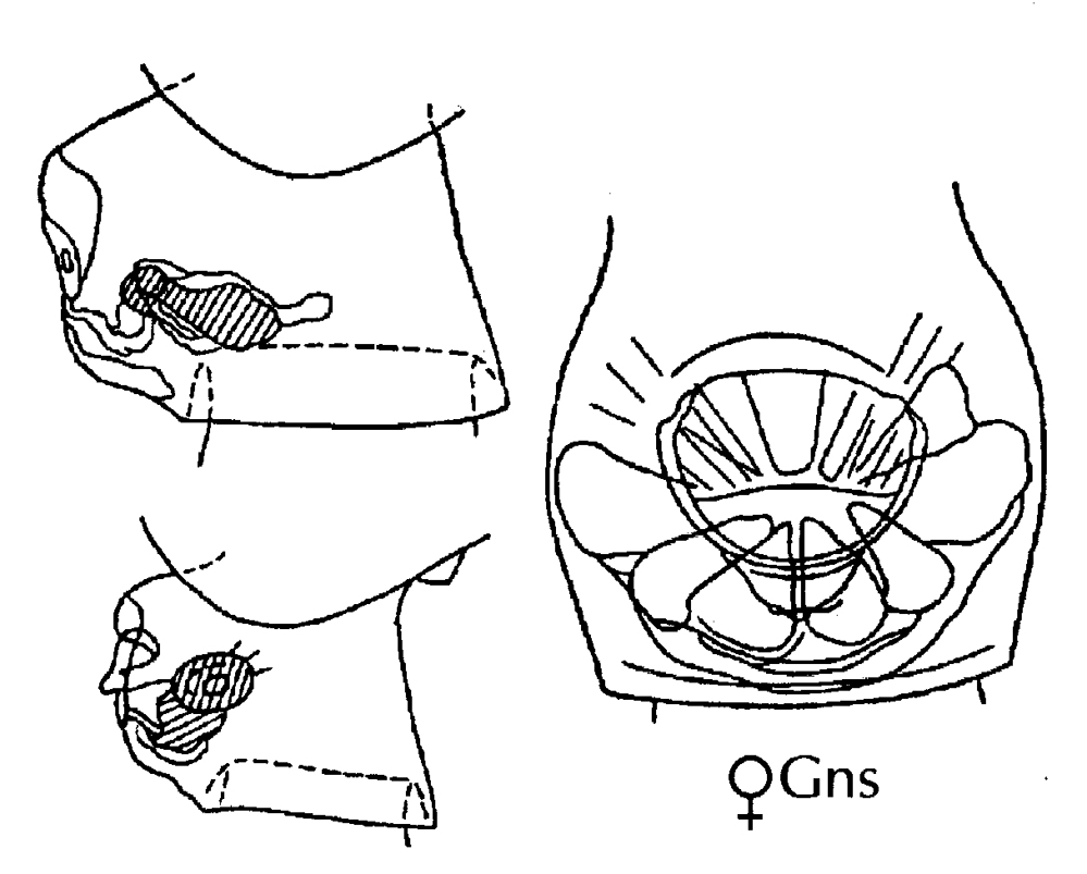 Espèce Neocalanus robustior - Planche 16 de figures morphologiques