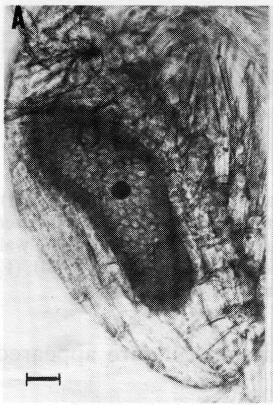 Species Pleuromamma gracilis - Plate 28 of morphological figures