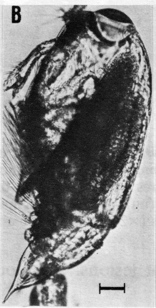 Espce Corycaeus (Agetus) typicus - Planche 15 de figures morphologiques
