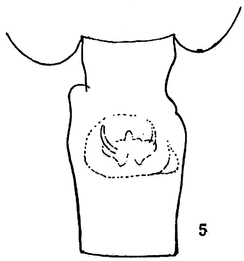 Espèce Euchaeta acuta - Planche 22 de figures morphologiques