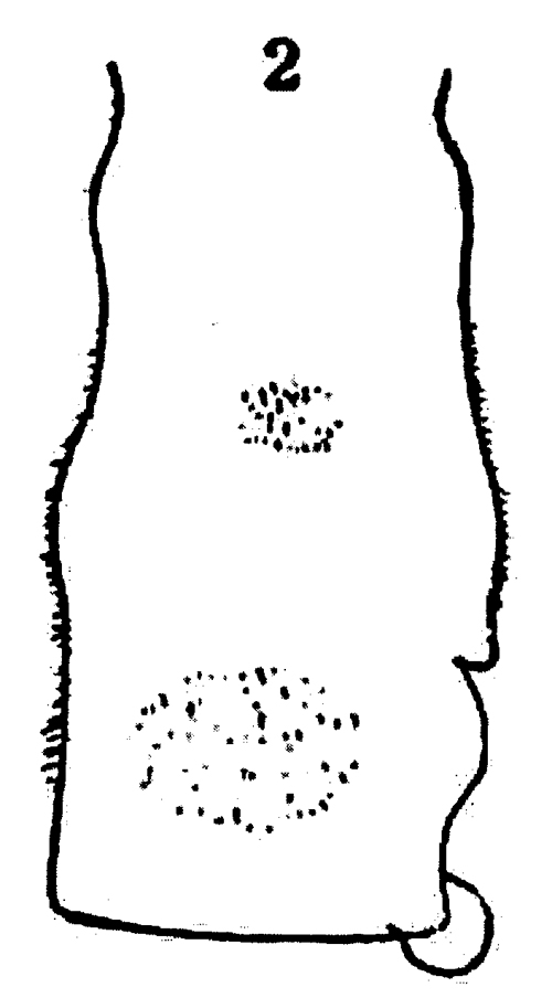 Espce Euchaeta indica - Planche 11 de figures morphologiques