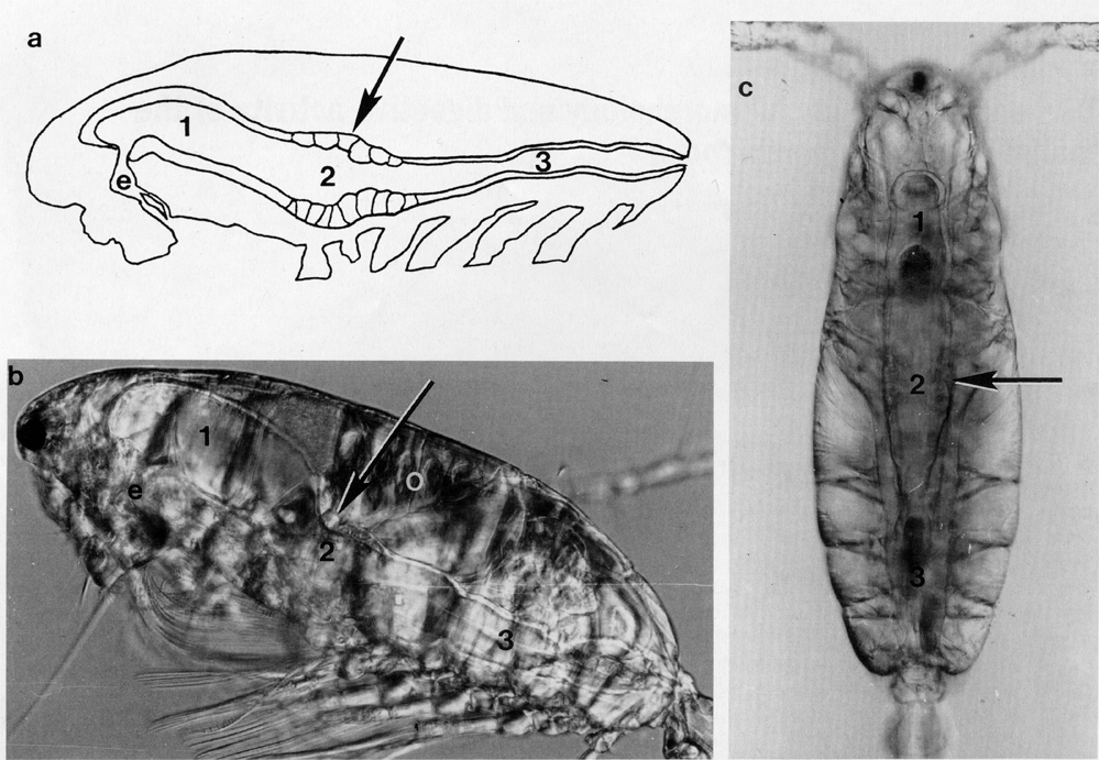 Espèce Acartia (Acanthacartia) tonsa - Planche 32 de figures morphologiques