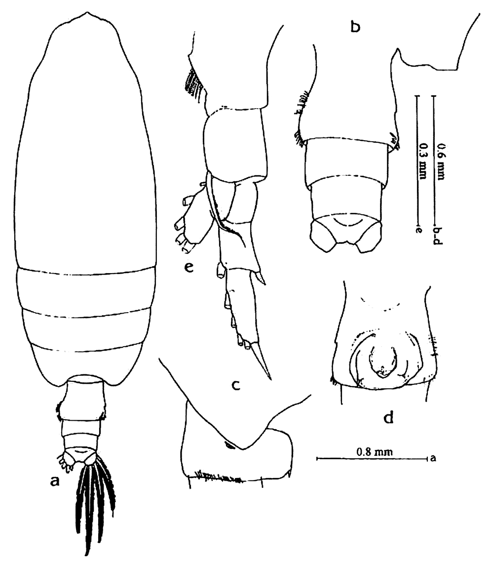 Espèce Undeuchaeta intermedia - Planche 9 de figures morphologiques