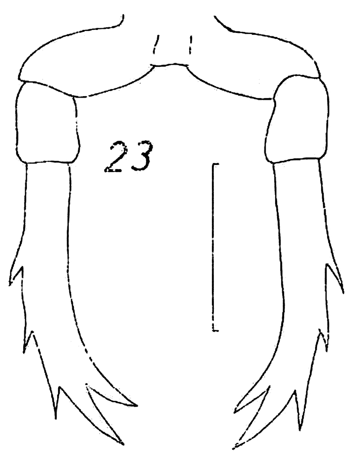 Espce Candacia sp.1 - Planche 1 de figures morphologiques