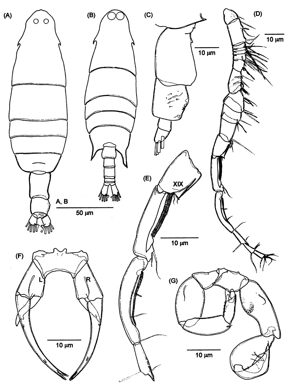 Espce Labidocera minuta - Planche 18 de figures morphologiques