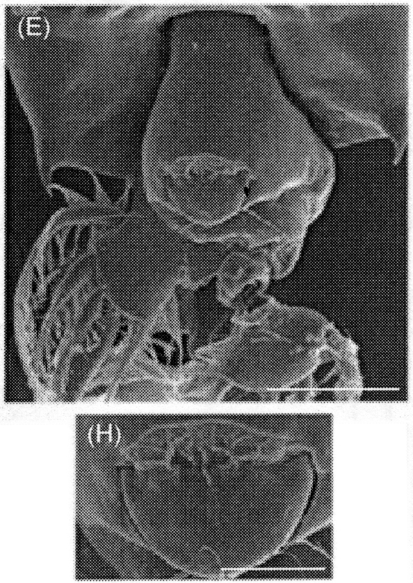 Species Labidocera detruncata - Plate 20 of morphological figures