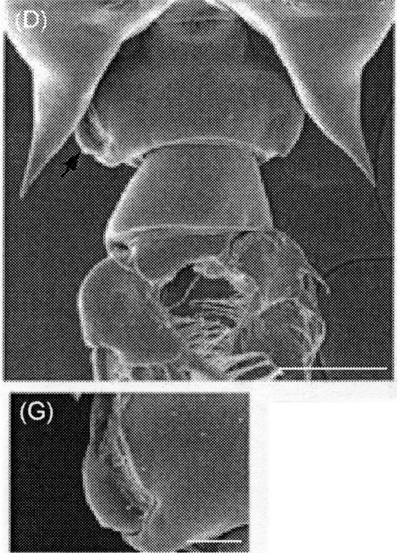 Espce Labidocera acutifrons - Planche 17 de figures morphologiques