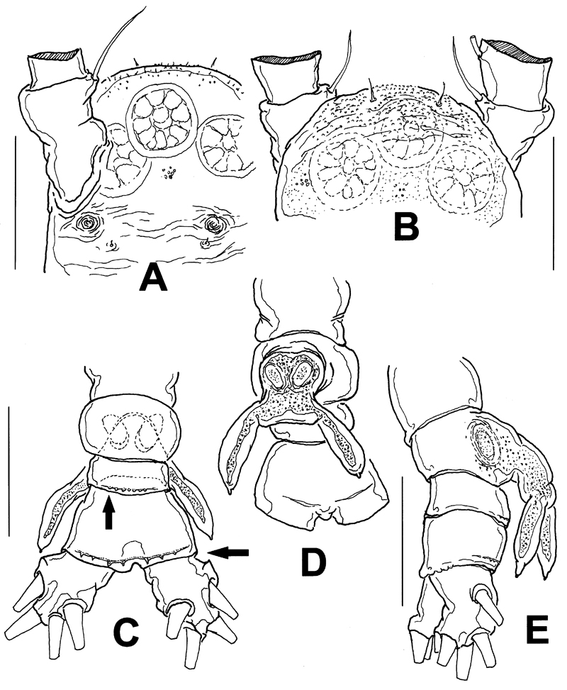 Espèce Monstrillopsis hastata - Planche 2 de figures morphologiques