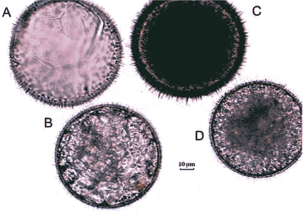 Species Paracartia grani - Plate 6 of morphological figures