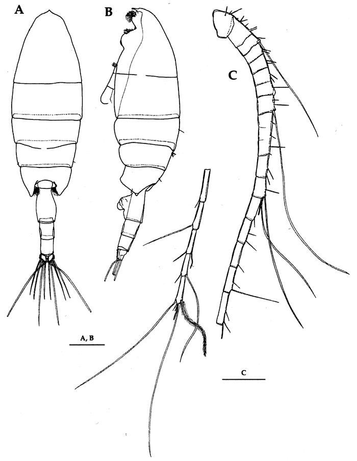 Espce Paraeuchaeta elongata - Planche 17 de figures morphologiques