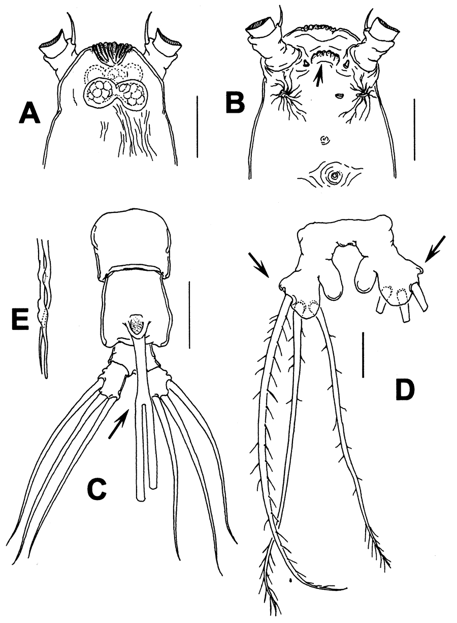 Species Cymbasoma sinopense - Plate 2 of morphological figures