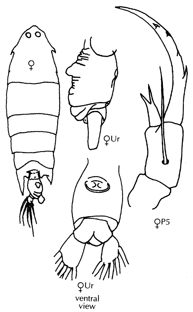 Espèce Pontella spinipes - Planche 11 de figures morphologiques