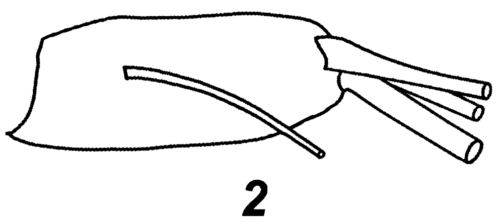 Espèce Centropages typicus - Planche 31 de figures morphologiques