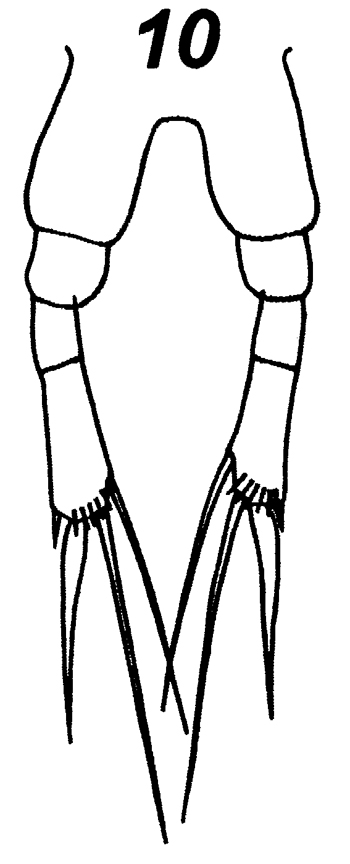 Espèce Calocalanus tenuis - Planche 6 de figures morphologiques