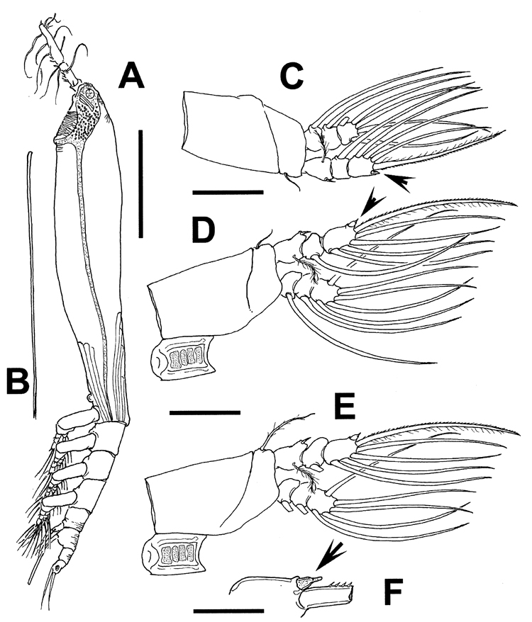 Espèce Cymbasoma tranteri - Planche 2 de figures morphologiques