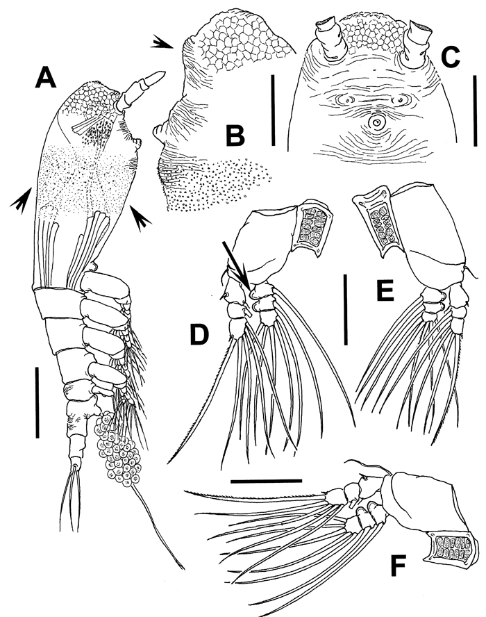 Espèce Cymbasoma tharawalorum - Planche 1 de figures morphologiques