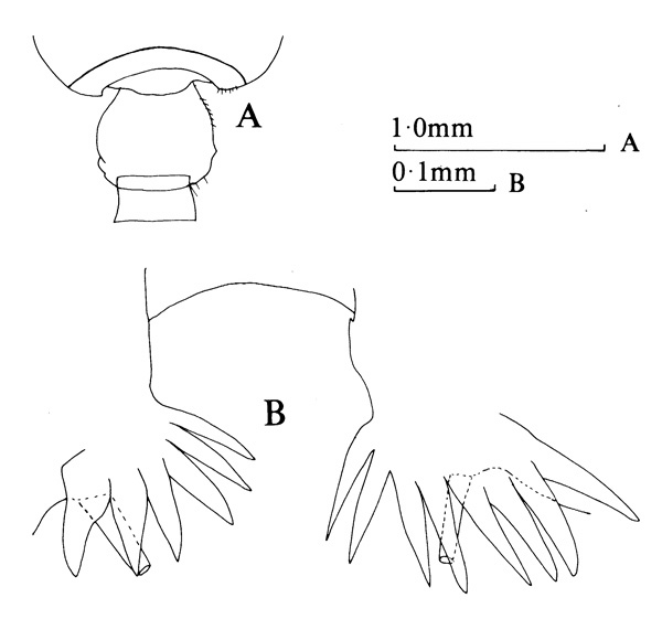 Espèce Pseudochirella notacantha - Planche 3 de figures morphologiques