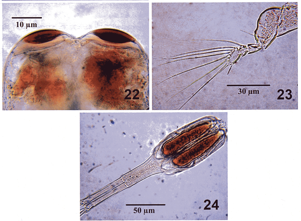 Espce Farranula gracilis - Planche 15 de figures morphologiques