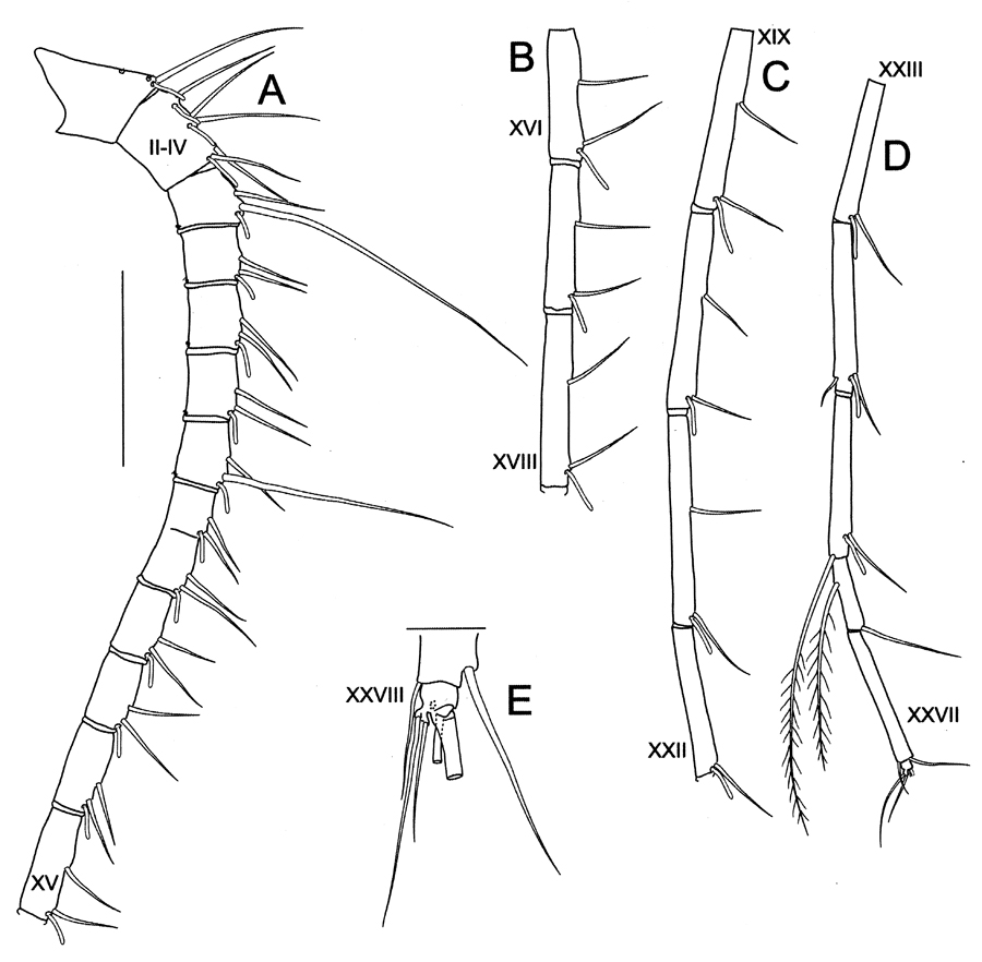 Espce Bathycalanus unicornis - Planche 4 de figures morphologiques
