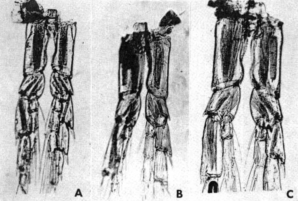 Espce Calanus finmarchicus - Planche 37 de figures morphologiques