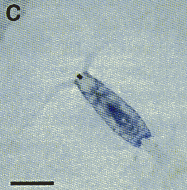 Species Acartia (Odontacartia) erythraea - Plate 17 of morphological figures