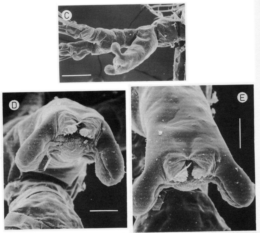 Espce Monstrillopsis dubia - Planche 5 de figures morphologiques
