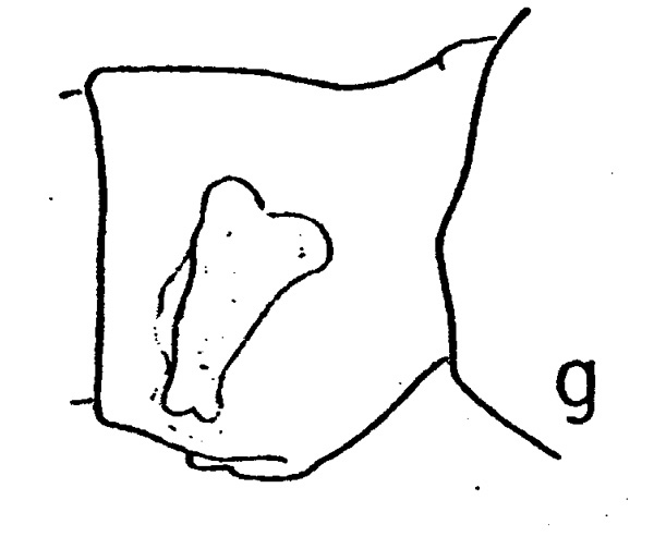 Espèce Subeucalanus pileatus - Planche 2 de figures morphologiques