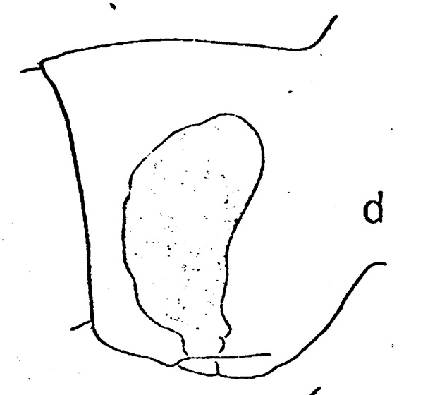Espèce Subeucalanus longiceps - Planche 4 de figures morphologiques