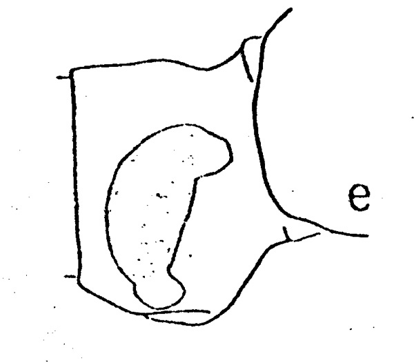 Espèce Subeucalanus monachus - Planche 2 de figures morphologiques