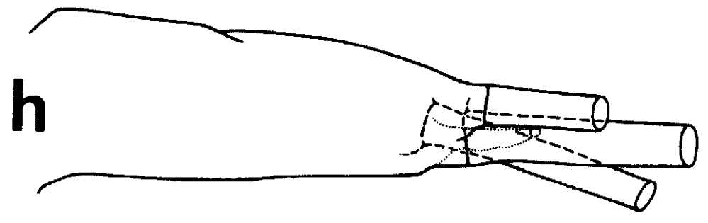 Species Undeuchaeta incisa - Plate 39 of morphological figures
