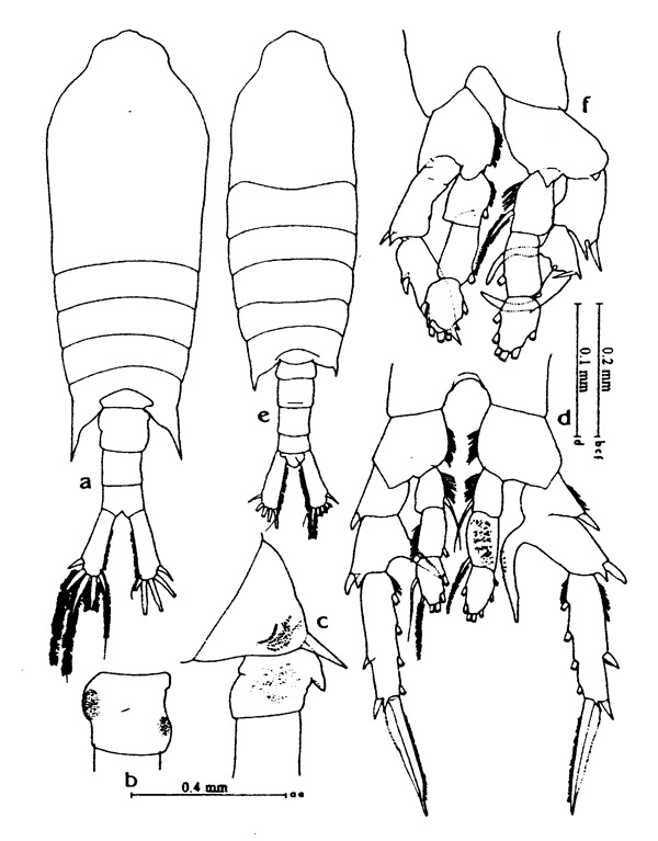 Espce Centropages tenuiremis - Planche 1 de figures morphologiques