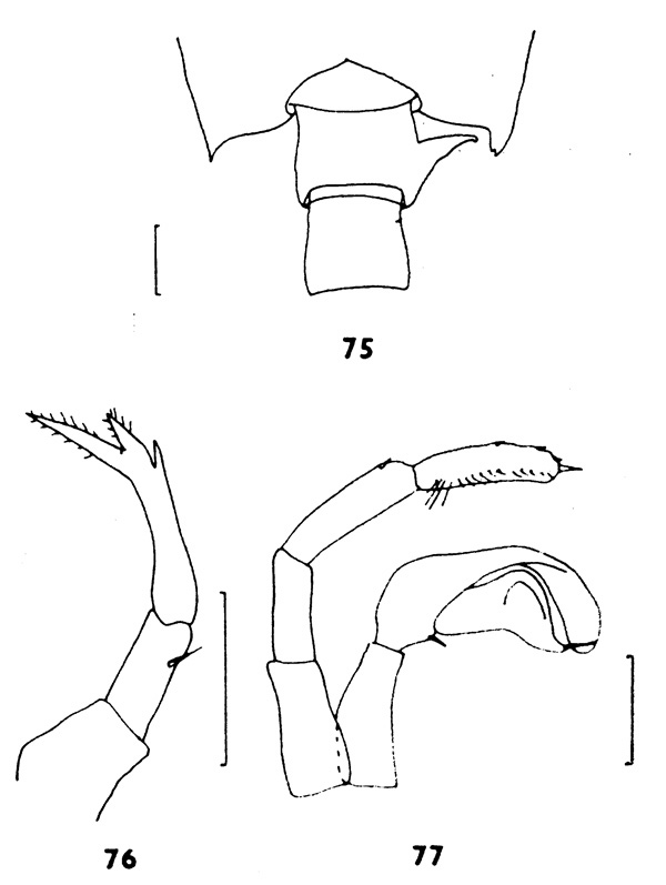 Espèce Candacia tenuimana - Planche 2 de figures morphologiques