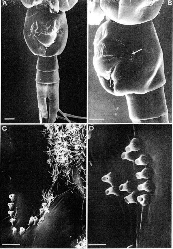 Espèce Heterorhabdus spinifrons - Planche 8 de figures morphologiques