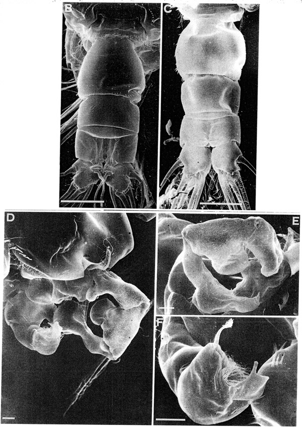 Espèce Acartia (Acanthacartia) tonsa - Planche 7 de figures morphologiques