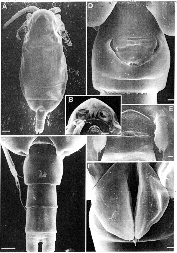 Species Scolecithricella dentata - Plate 7 of morphological figures
