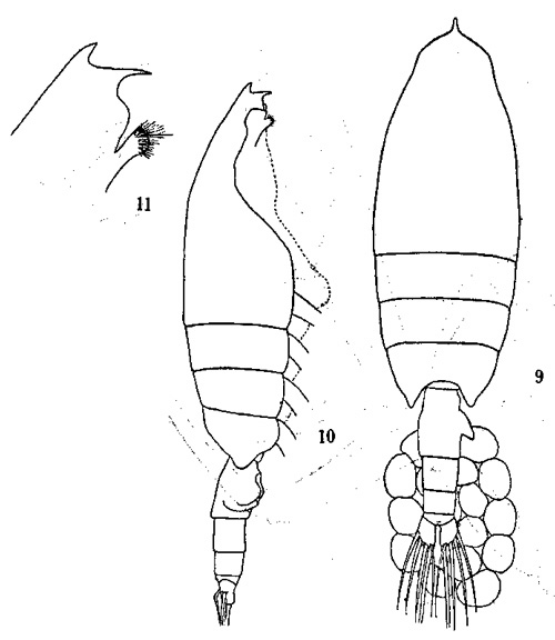 Espce Euchaeta concinna - Planche 3 de figures morphologiques