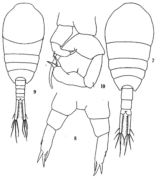 Espèce Temora turbinata - Planche 3 de figures morphologiques