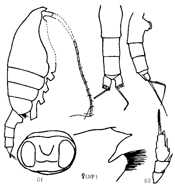 Espce Paraeuchaeta modesta - Planche 1 de figures morphologiques