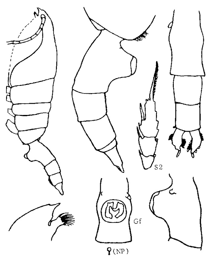 Espce Paraeuchaeta abyssalis - Planche 2 de figures morphologiques