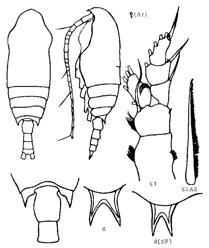 Espèce Aetideopsis rostrata - Planche 11 de figures morphologiques