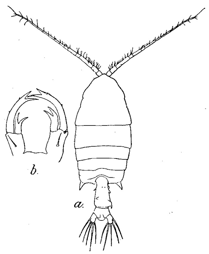 Espce Pontellopsis herdmani - Planche 2 de figures morphologiques