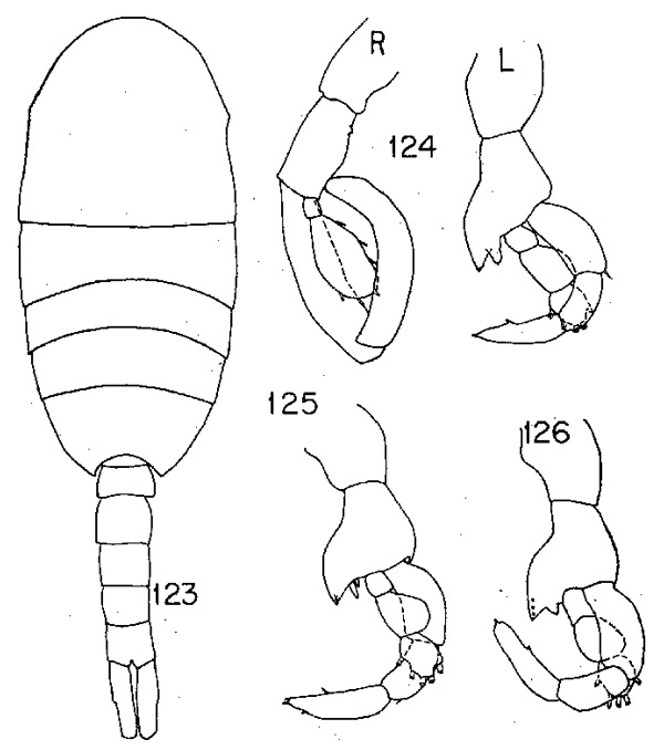 Espèce Lucicutia clausi - Planche 11 de figures morphologiques